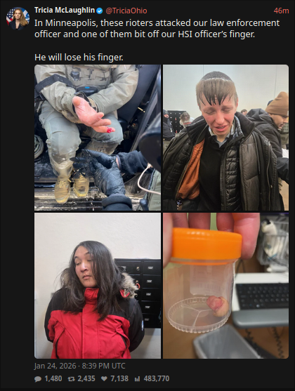 [Image: d5ff18d8dcb5a395fd88e23df6a4a37d.png]
