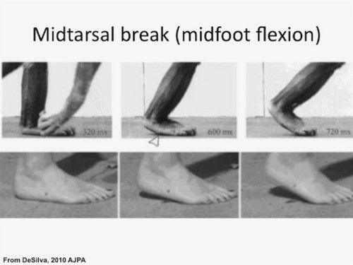 [Image: mid-tarsal-break-1591515307.jpeg]